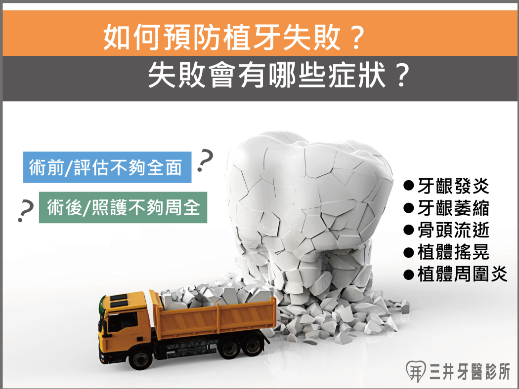 如何預防植牙失敗？All on 4 & All on 6 失敗會有哪些症狀？