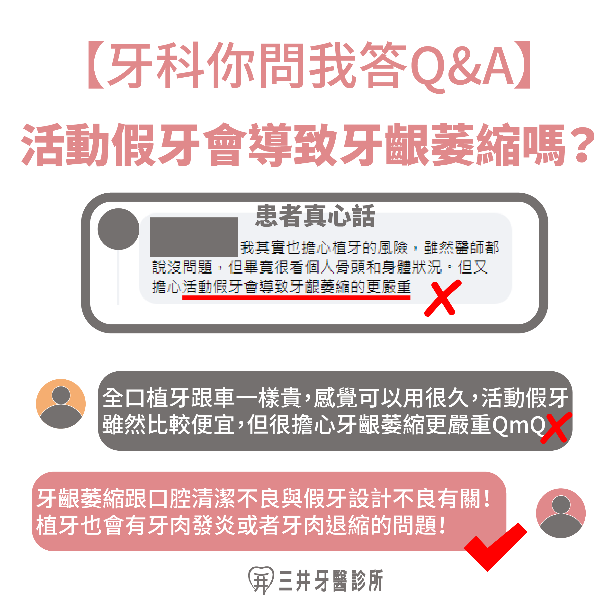 活動假牙會導致牙齦萎縮嗎？